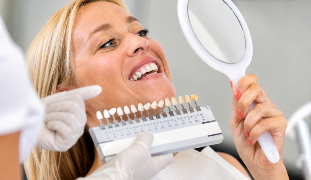 Bright Dental Shade Matching Consultation