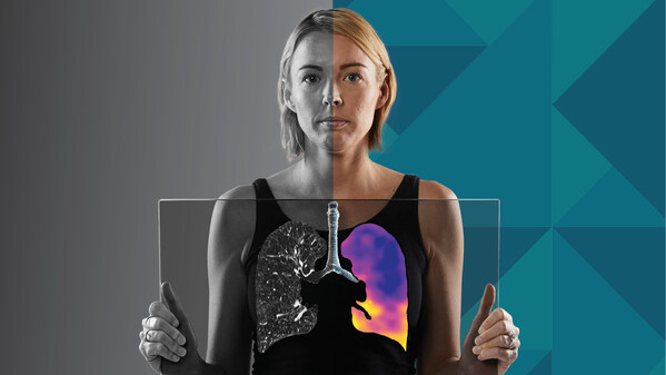 Australia becomes the latest market to grant regulatory approval for 4DMedical’s CT:VQ. Australia becomes the latest market to grant regulatory approval for 4DMedical’s CT:VQ.